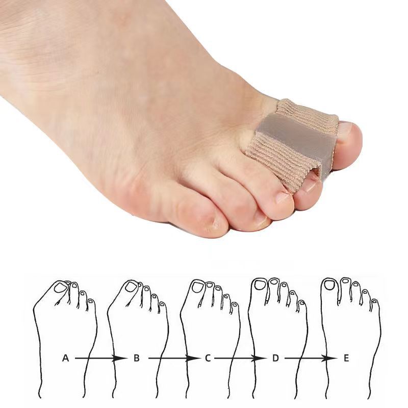 Barevo Toe Separator